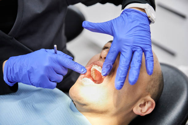 Best Emergency Root Canal Treatment in Clever, MO