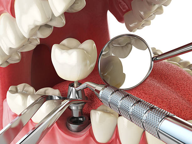 Best Weekend Emergency Dentist in Clever, MO